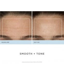 NuFACE Trinity Pro Facial Toning Kit