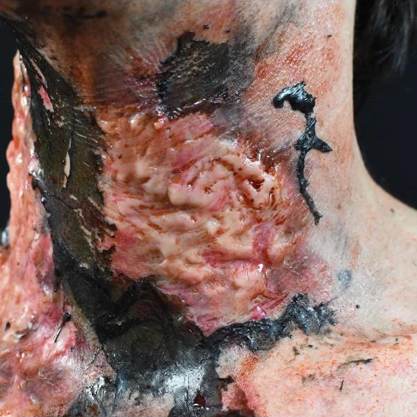 Out Of Kit Burn (Medium) 2 Out Of Kit Burn (Medium)