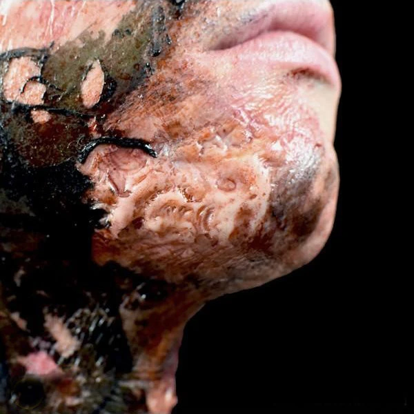 Out Of Kit Burn (Small) Special FX 2 Out Of Kit Burn (Small) Special FX