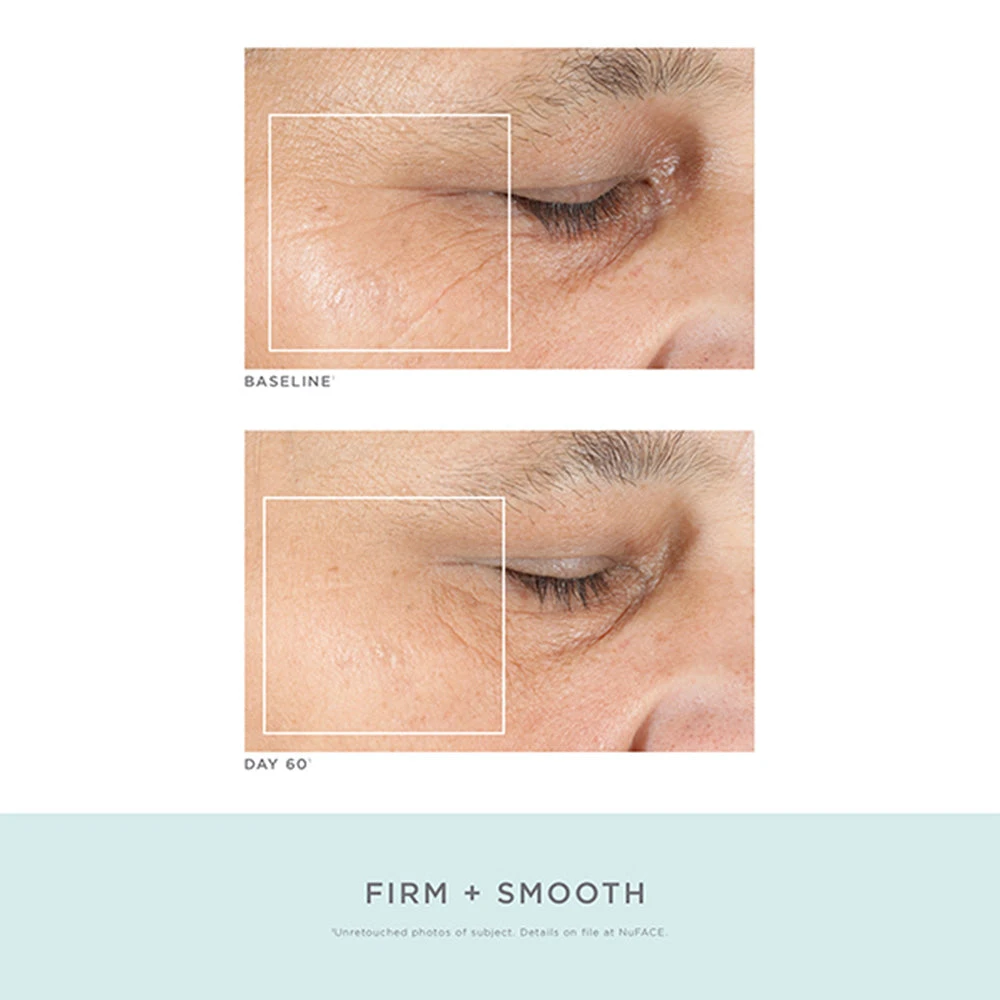 NuFACE Trinity Pro Facial Toning Kit + ELE 8 NuFACE Trinity Pro Facial Toning Kit + ELE