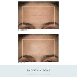 NuFACE Trinity Pro Facial Toning Kit + Wrinkle Reducer