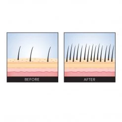 Philip B Scalp Booster