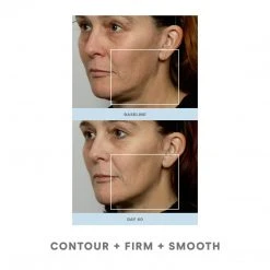 NuFACE Trinity Pro Facial Toning Kit + ELE 12 NuFACE Trinity Pro Facial Toning Kit + ELE