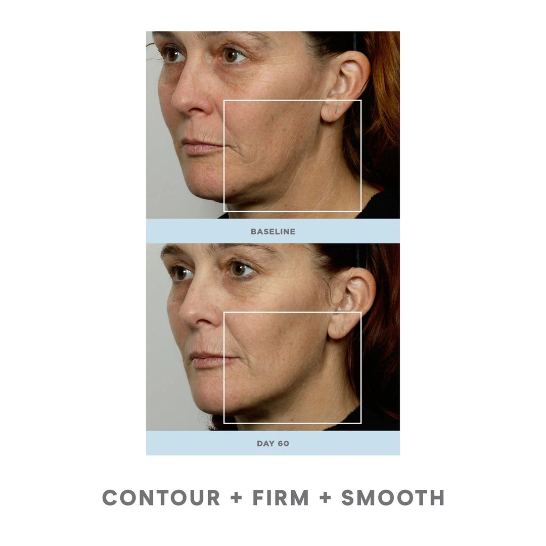 NuFACE Trinity Pro Facial Toning Kit + ELE 4 NuFACE Trinity Pro Facial Toning Kit + ELE