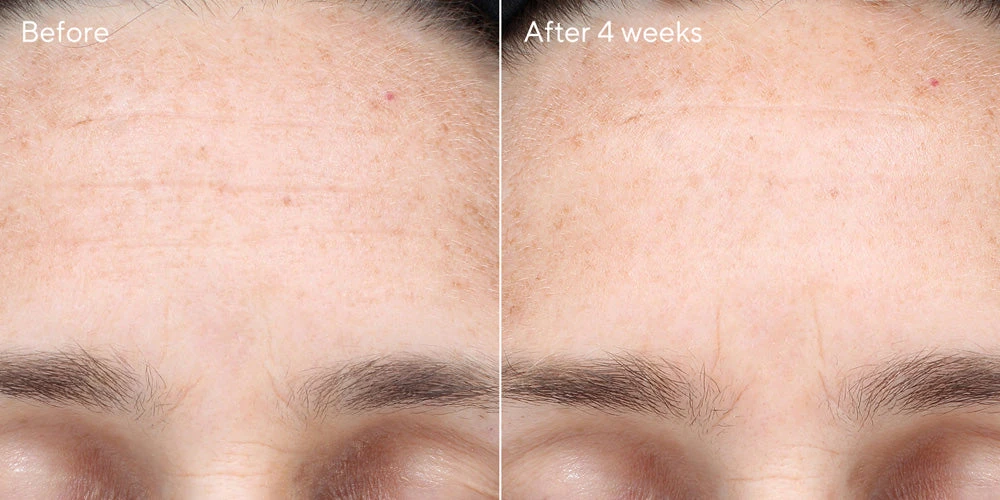 Murad Multi-Vitamin Infusion Oil Skincare 3 Murad Multi-Vitamin Infusion Oil Skincare