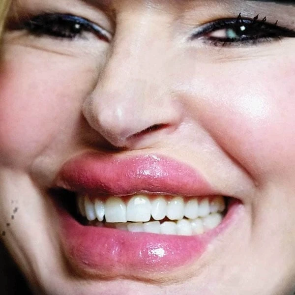 Tinsley Transfers Lip/Tuck - 3D FX Transfer Special FX